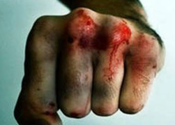 На Тернопільщині нелюд забив до смерті односельця…