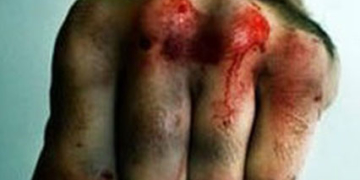 На Тернопільщині нелюд забив до смерті односельця…