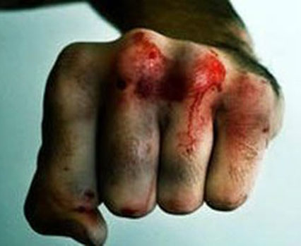 На Тернопільщині нелюд забив до смерті односельця…