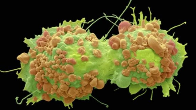 У високих людей більше шансів захворіти на рак