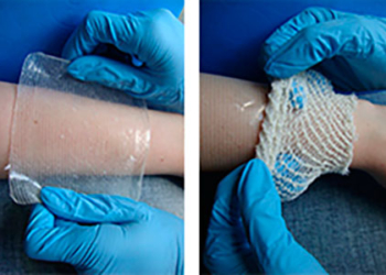 Винахід львівських вчених допоможе у лікуванні