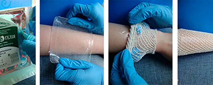 Винахід львівських вчених допоможе у лікуванні