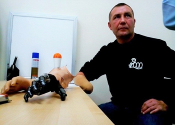 Одеські лікарі зробили «другу» руку пораненому бійцю