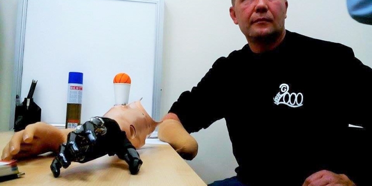 Одеські лікарі зробили «другу» руку пораненому бійцю