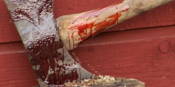 Колишня співмешканка вдарила чоловіка по голові… сокирою