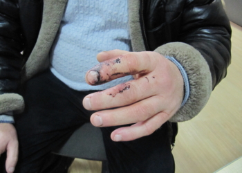 Наша поліція нас… кусає!