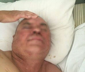 Жінка “підняла на ноги” поліцейських Тернополя через свого чоловіка