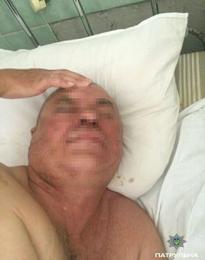 Жінка “підняла на ноги” поліцейських Тернополя через свого чоловіка