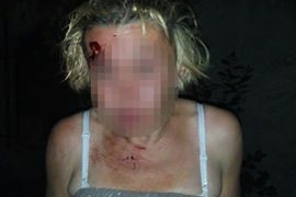 Яке їхало, таке й здибало: у Тернополі побилися п’яні чоловік та жінка