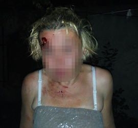 Яке їхало, таке й здибало: у Тернополі побилися п’яні чоловік та жінка