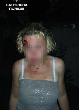 Яке їхало, таке й здибало: у Тернополі побилися п’яні чоловік та жінка