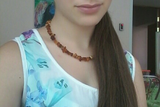 Функцію нирок у 15-річної Тані з Тернополя виконує спеціальний апарат