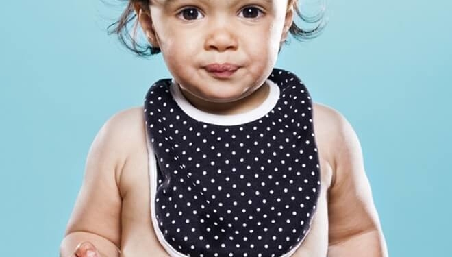 Ці фото змусять вас скривитися, ніби ви з’їли лимон (фото)