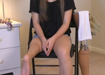 Юна балерина танцює з ампутованою ногою (відео)