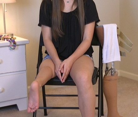 Юна балерина танцює з ампутованою ногою (відео)