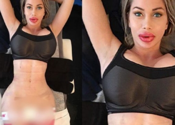 Як виглядає дівчина з найбільшими силіконовими губами, яка не планує зупинятися (фото)