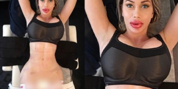 Як виглядає дівчина з найбільшими силіконовими губами, яка не планує зупинятися (фото)