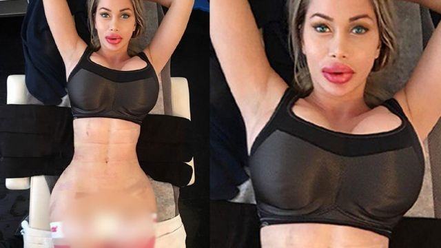 Як виглядає дівчина з найбільшими силіконовими губами, яка не планує зупинятися (фото)