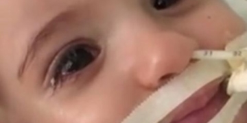 За секунду до відключення системи життєзабезпечення однорічна дівчинка вийшла з коми