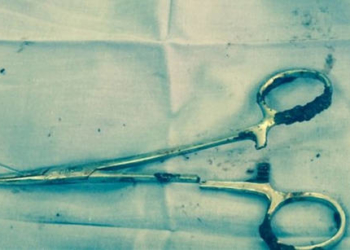 Під час операції медики у животі чоловіка забули ножиці