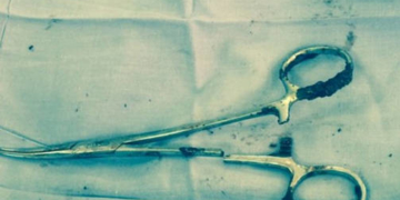 Під час операції медики у животі чоловіка забули ножиці