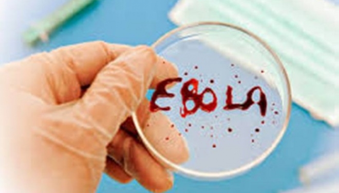 Чим небезпечний вірус Ебола