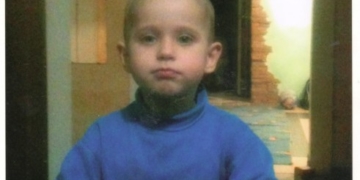 У трьохрічного тернополянина рідкісна вада, яка трапляється в однієї людини зі ста тисяч