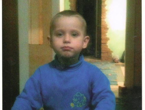 У трьохрічного тернополянина рідкісна вада, яка трапляється в однієї людини зі ста тисяч