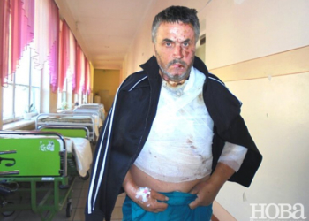 З пекельним болем від опіків тернополянин ледве доїхав у бусі з Польщі