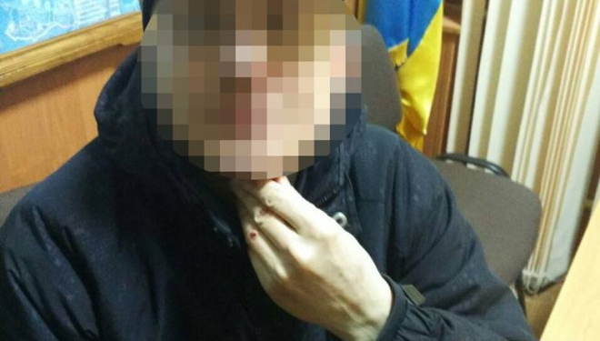 Як два п’яні чоловіки з Тернополя самі “нарвалися”