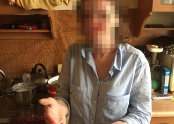Через сварку двох жінок викликали поліцейських