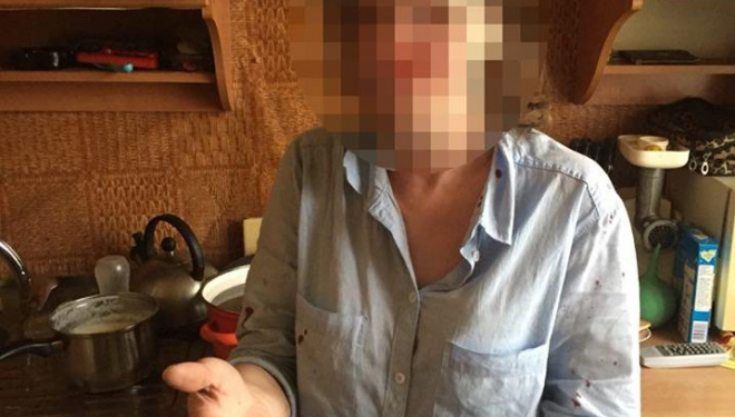 Через сварку двох жінок викликали поліцейських