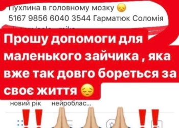 Тернополян благають допомогти маленькій дівчинці