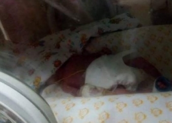 У Тернополі народилася дитинка, яка важить 540 грам