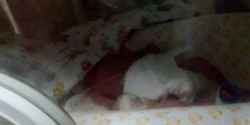 У Тернополі народилася дитинка, яка важить 540 грам