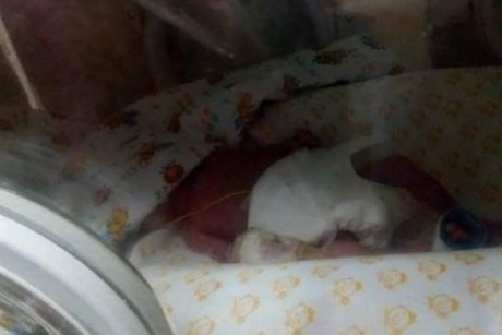 У Тернополі народилася дитинка, яка важить 540 грам