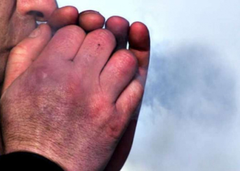 На Кременеччині від переохолодження помер чоловік