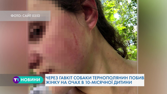 В Тернополі невідомий чоловік напав на матір з немовлям (Відео)