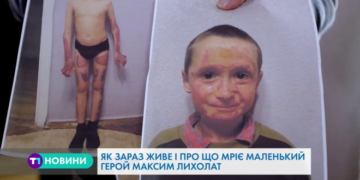 Історія про те, як склалася доля маленького тернополянина, який постраждав від вибуху (Відео)