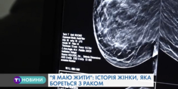 У Тернополі запрацював єдиний в Україні мамограф-томограф