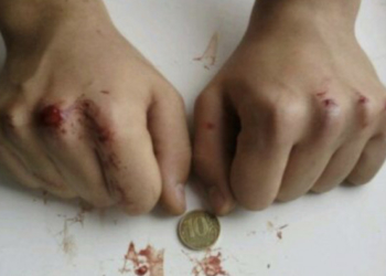 Тернопільським батькам слід бути пильними: підлітки “підсіли” на нову небезпечну гру