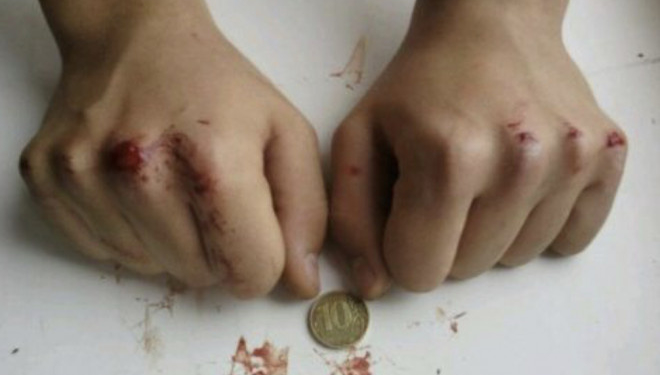 Тернопільським батькам слід бути пильними: підлітки “підсіли” на нову небезпечну гру