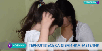 Одні на декілька тисяч: як живе тернопільська дівчинка-“метелик”