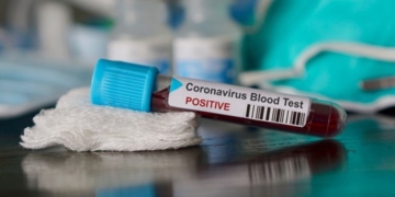 На Тернопільщині перший летальний випадок із захворюванням на COVID-19