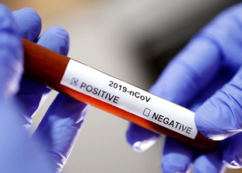 Зафіксований перший випадок COVID-19 у Тернополі