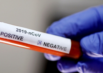 Тернополян закликають звертатися на «гарячу лінію» щодо ймовірного занедужання на коронавірус