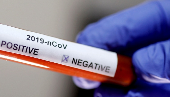 Тернополян закликають звертатися на «гарячу лінію» щодо ймовірного занедужання на коронавірус