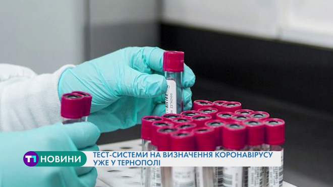 До Тернополя прибули тест-системи для визначення коронавірусної інфекції