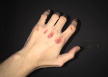 У Тернополі жінки побилися за “серце” чоловіка