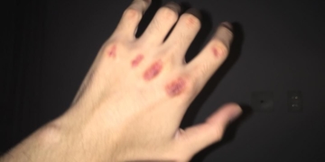 У Тернополі жінки побилися за “серце” чоловіка